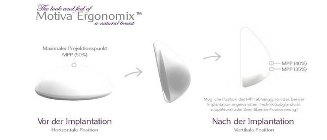 Motiva Ergonomix